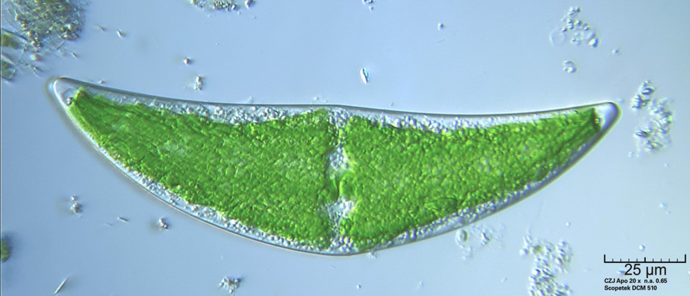 Closterium